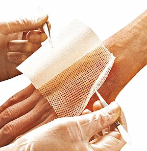 Jelonet Paraffin Gauze Dressing – Low-Adherent & Soothing Care